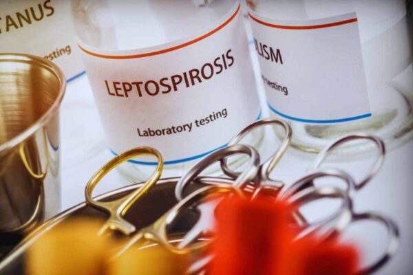 Yale researchers develop novel test for leptospirosis