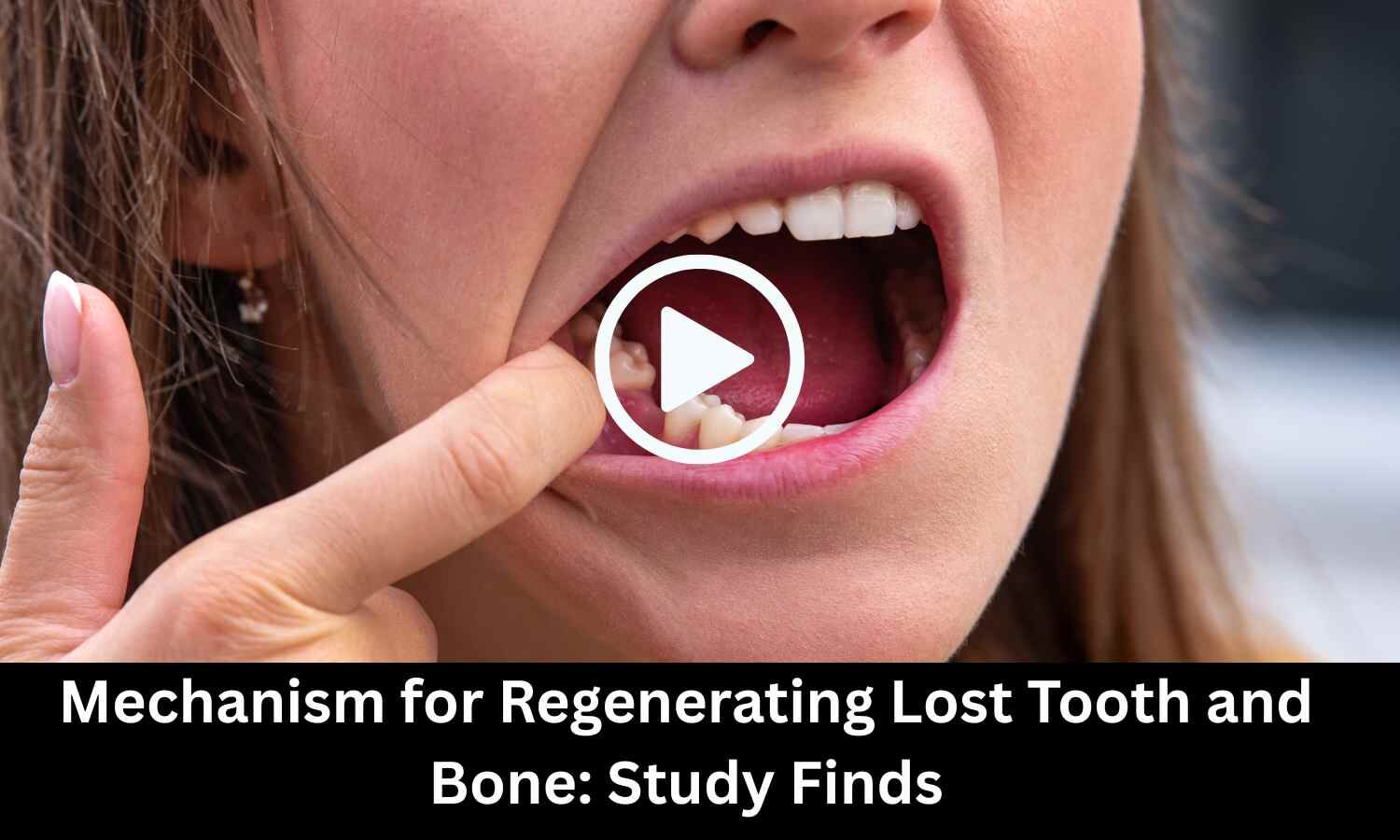 Study Uncovers Mechanism for Regenerating Lost Tooth and Bone
