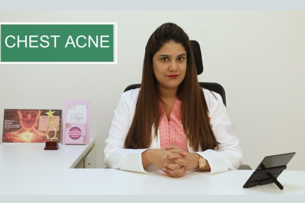 Managing Chest Acne – The Overlooked Breakouts with dermatologist Dr Sravya Tipirneni Managing Chest Acne – The Overlooked Breakouts with dermatologist Dr Sravya Tipirneni