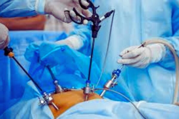 Endoscopic Purse-String Suturing Proves Safe and Effective for Small ADAFs, Reveals Research Endoscopic Purse-String Suturing Proves Safe and Effective for Small ADAFs, Reveals Research