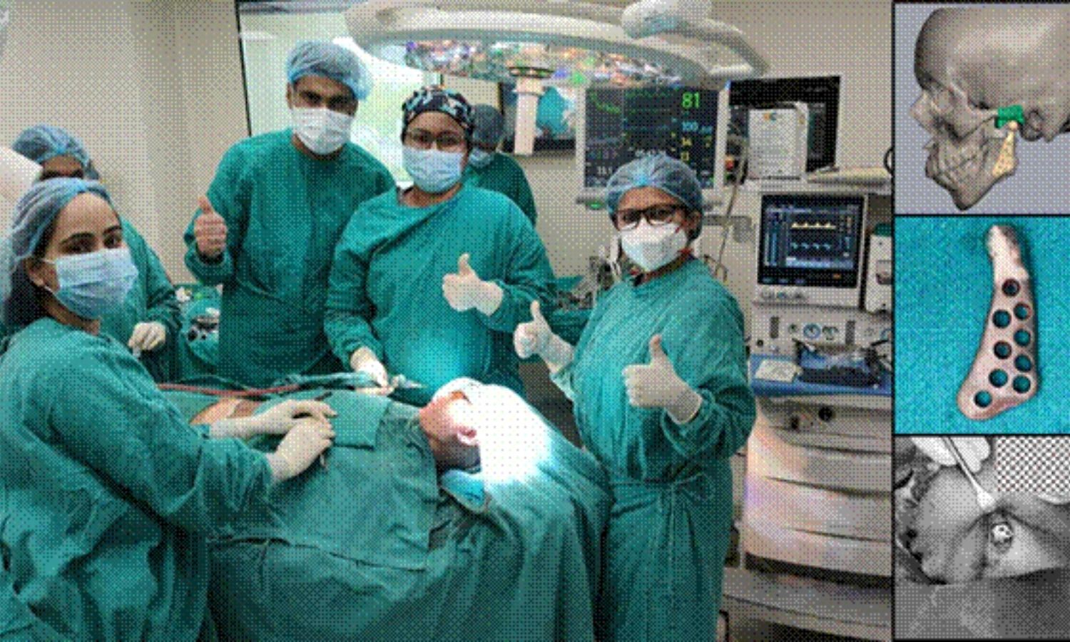 MAIDS performs customised implant surgeries on 4 patients