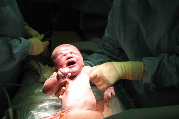 Study highlights risks of Caesarean births to future pregnancies Study highlights risks of Caesarean births to future pregnancies