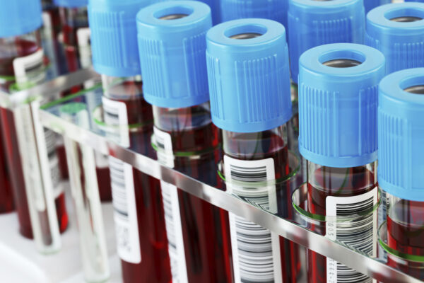 FDA clears Roche, Lilly Alzheimer’s blood test