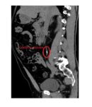 Imaging Case of the Week 301 Answer