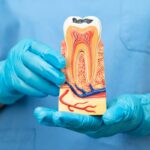Top Signs You Need a Root Canal Before It’s Too Late