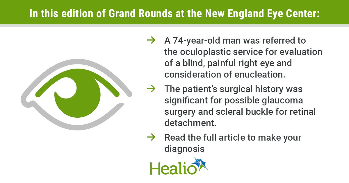 Man presents with blind, painful right eye