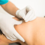 Unlocking Muscle Pain with Dry Needling