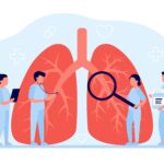 Boehringer’s Jascayd nets first FDA IPF approval in over 10 years
