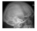 Imaging Case of the Week 263