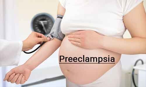 Risk factors associated with early and late onset preeclampsia:IJOGR