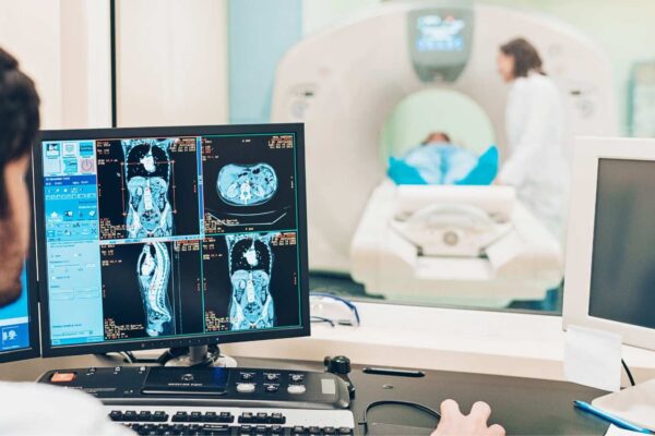 RV Global Longitudinal Strain on Cardiac MRI Predicts Future Heart Failure: Study