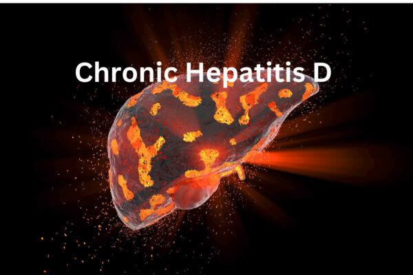 Dual Therapy Shows Antiviral Activity in Chronic Hepatitis D Patients: NEJM