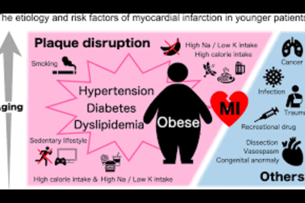 Abnormal Free Fatty Acids Amplify Long-Term Cardiovascular Risk in Premature MI: Study