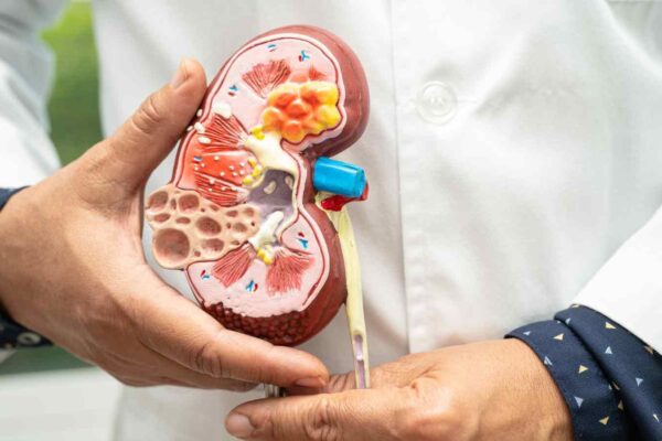 Albumin-Specific Testing Outperforms Total Protein Measurement in Detecting Kidney Disease: Study