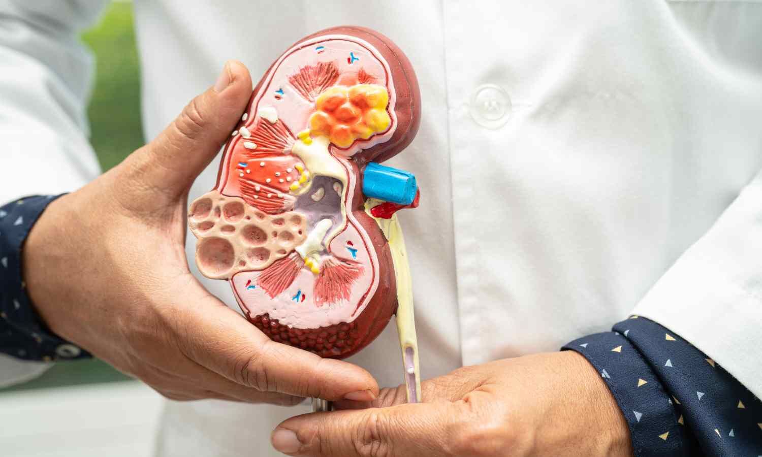 Albumin-Specific Testing Outperforms Total Protein Measurement in Detecting Kidney Disease: Study