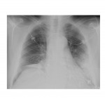 Imaging Case of the Week 31