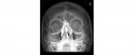 Imaging Case of the Week 32
