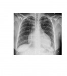 Imaging Case of the Week 59