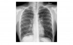 Imaging Case of the Week 81