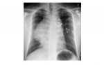 Imaging Case of the Week 85