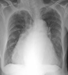 Imaging Case of the Week 39