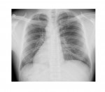 Imaging Case of the Week 78