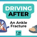 When to Drive After an Ankle Fracture (Broken Malleolus)?