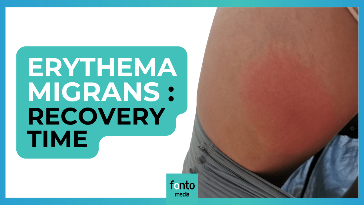 Erythema Migrans (Lyme Disease): Progression and Symptoms