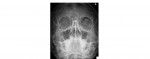 Imaging Case of the Week 47