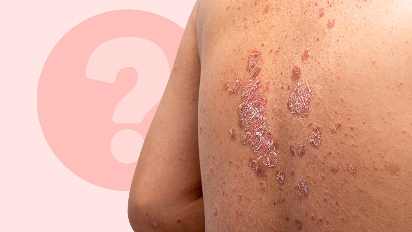 Facts You Need to Know