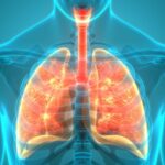 Triple CFTR Modulator Therapy Shows Sustained Reduction in Inflammation in Cystic Fibrosis: Study