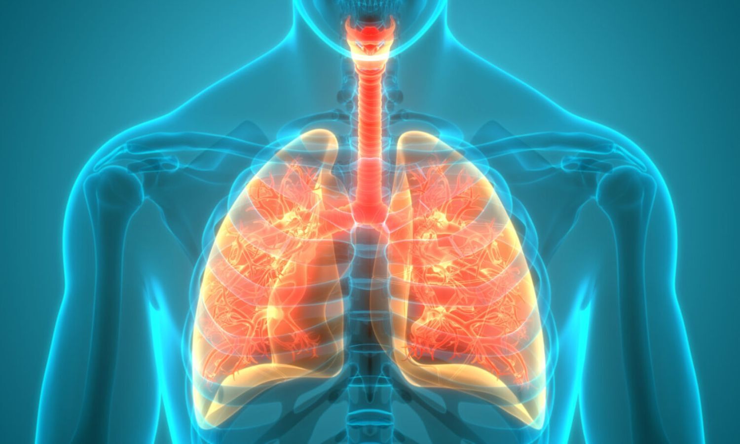 Triple CFTR Modulator Therapy Shows Sustained Reduction in Inflammation in Cystic Fibrosis: Study