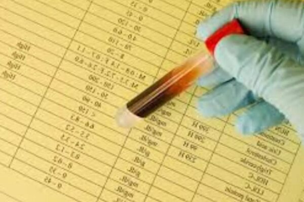 Higher TyG Index Independently Predicts Carotid Plaque Progression in Type 2 Diabetes: Study