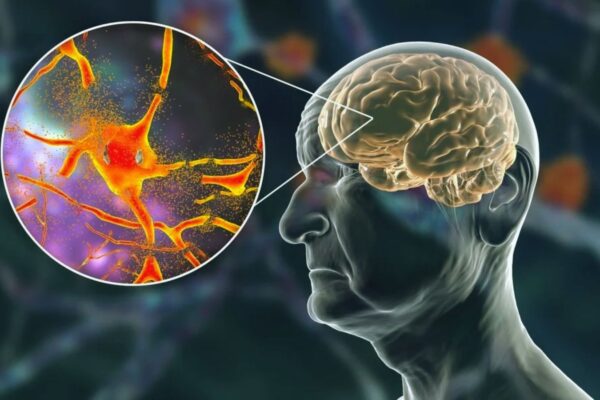 More muscle, less belly fat slows brain aging, suggests research