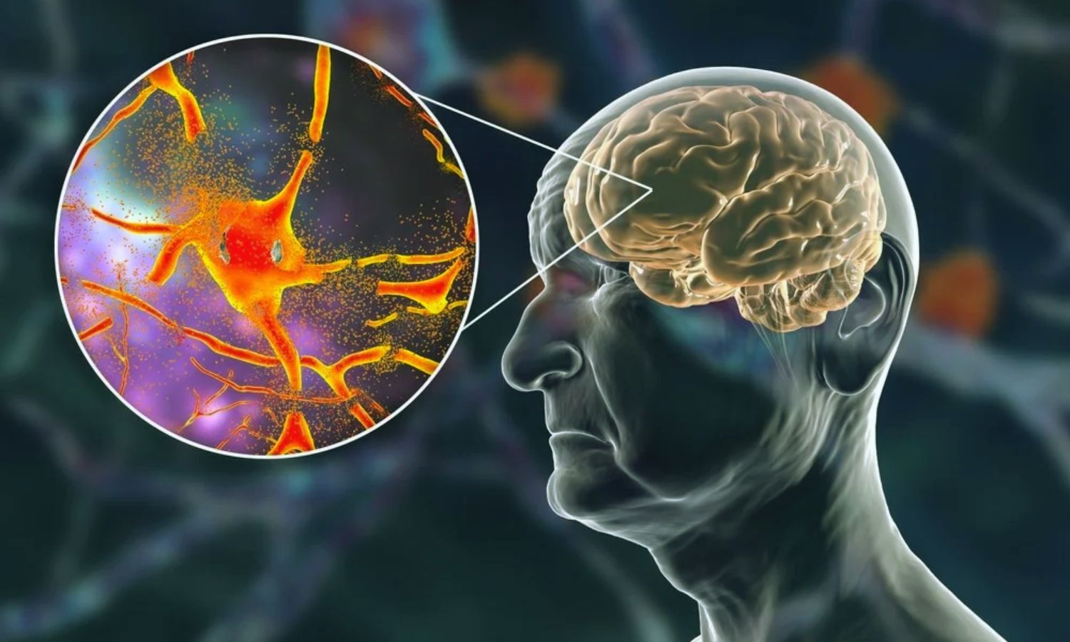 More muscle, less belly fat slows brain aging, suggests research