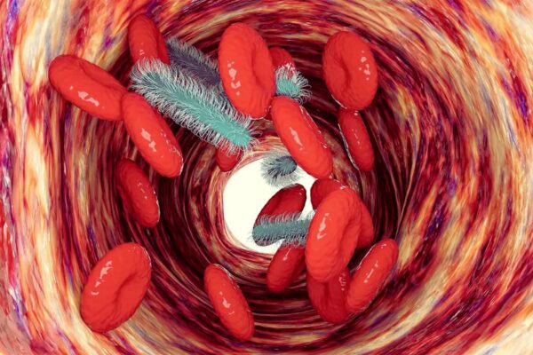 Precision Immunotherapy Improves Organ Function in Sepsis: ImmunoSep Trial