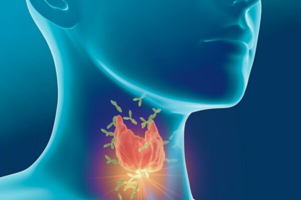 Thyroid Antibodies May Predict Heart Disease and Stroke Risk, Major Analysis Finds