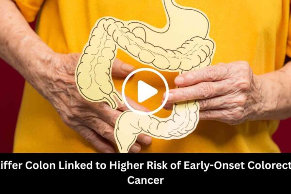 Stiffer Colon Linked to Higher Risk of Early-Onset Colorectal Cancer