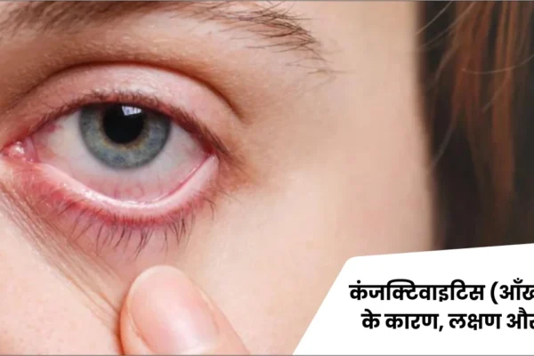 कंजंक्टिवाइटिस (आंख आना) के कारण, लक्षण और उपचार