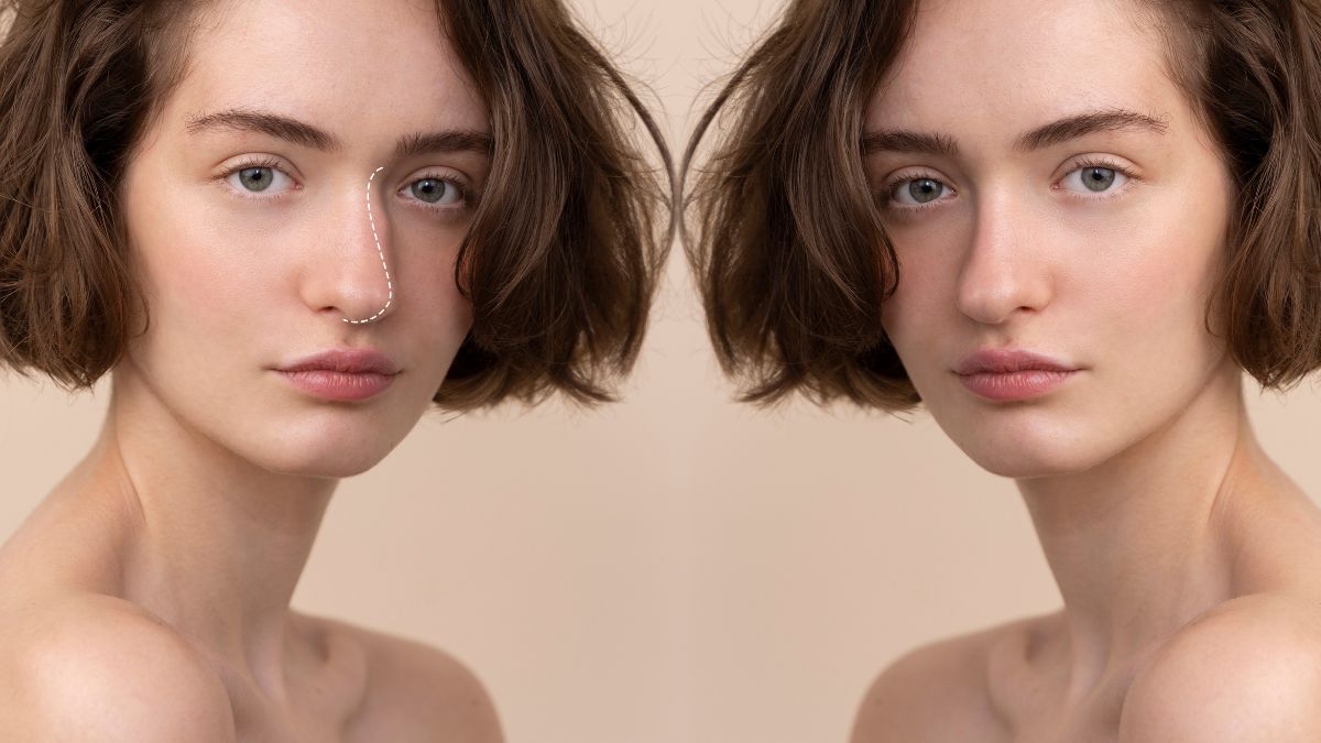 What is The Viability Of Rhinoplasty For Different Age Groups?