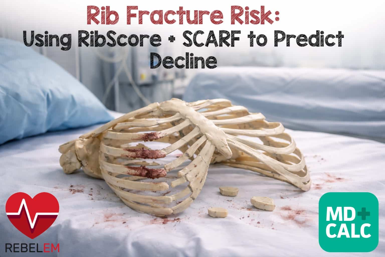 Rib Fracture Risk: Using RibScore + SCARF to Predict Decline