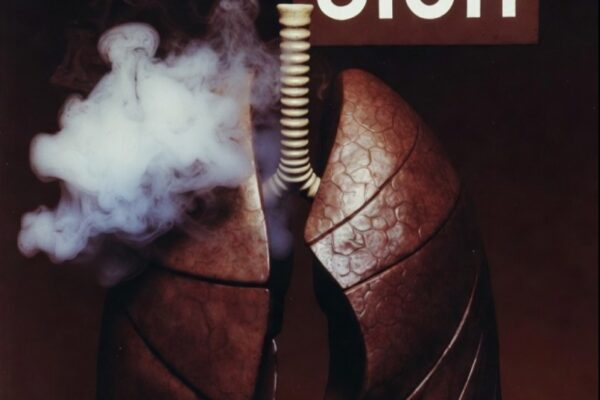 SIGH35 vs. EEOT in ICU