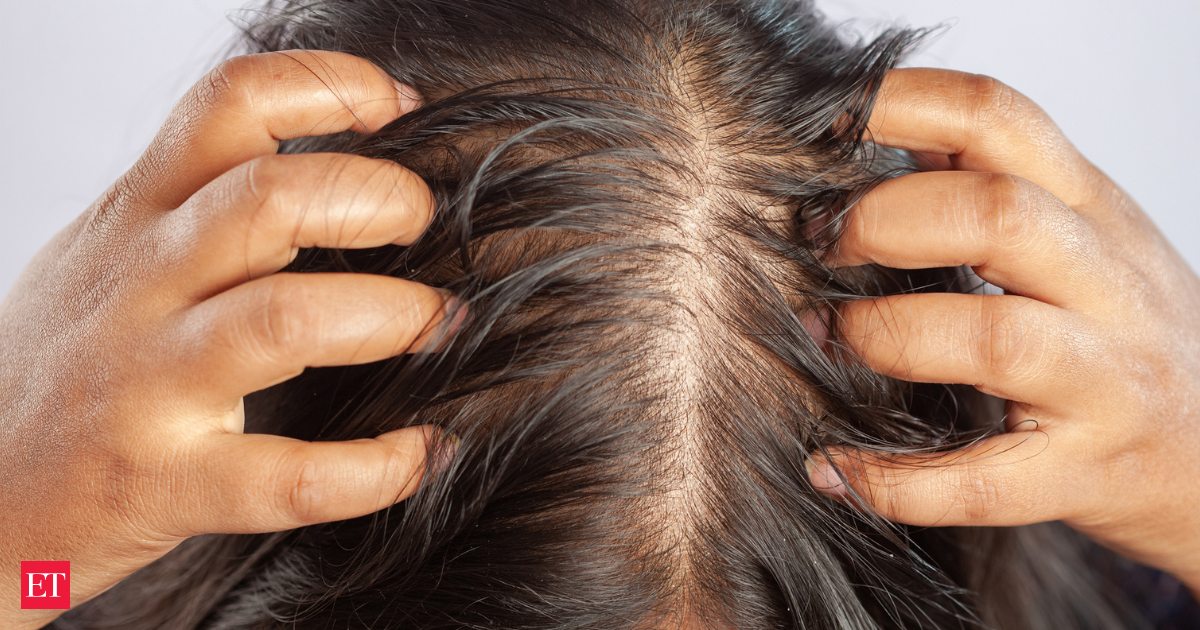 Alkem Laboratories introduces hair growth support therapy kit