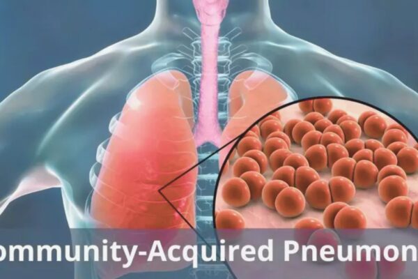 Traditional Chinese Medicine Injections Show Potential Benefit in Older Adults With Community-Acquired Pneumonia