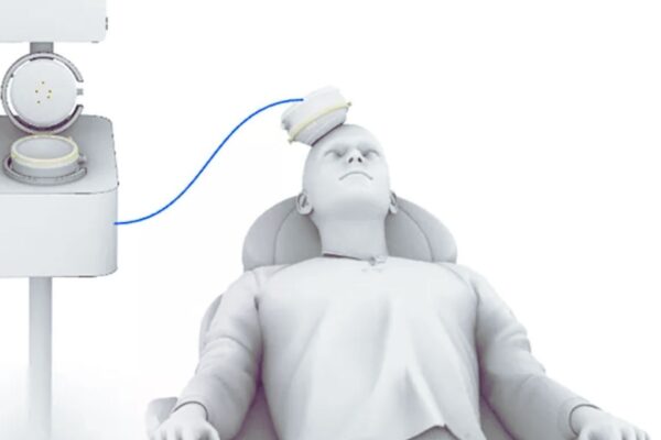 Transcranial Ultrasound Stimulation Significantly Improves Depression, Reports Research