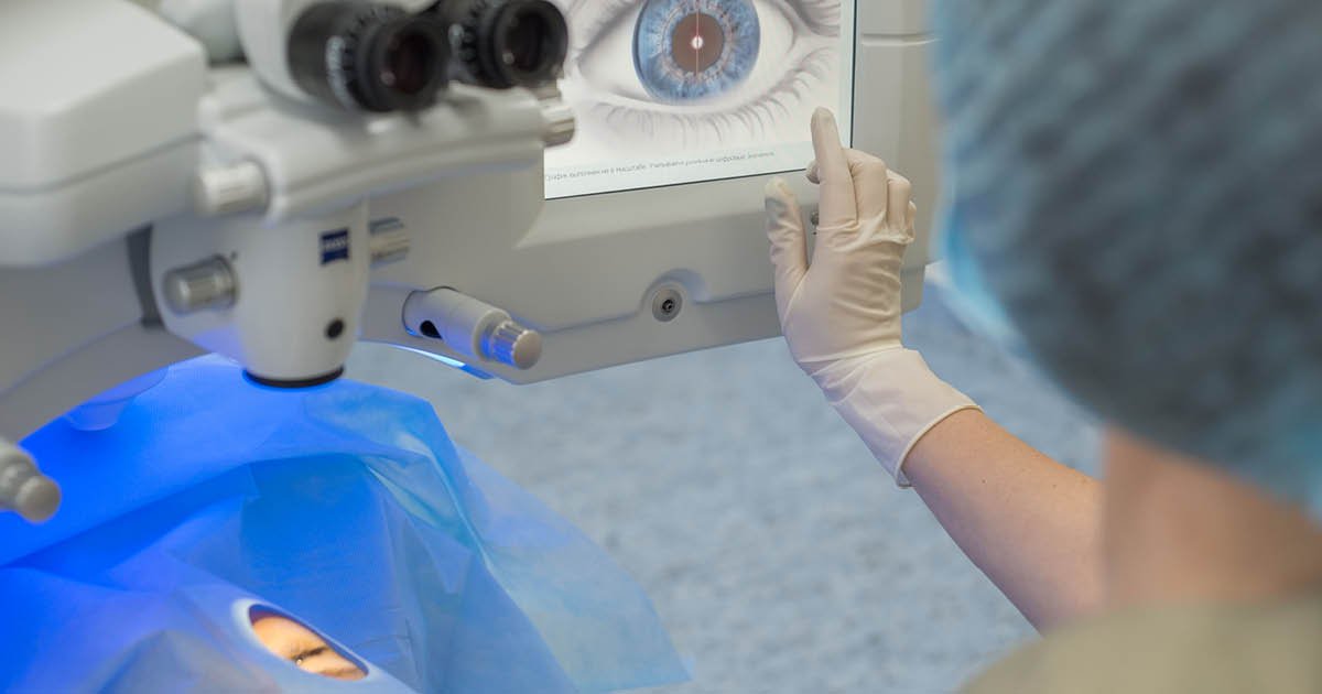 SMILE provides predictable correction for some astigmatism types